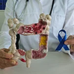 Dr. Carles Tropa (43), oncólogo: «El cáncer de colon avisa con este cambio en tus uñas que el 90% ignora por completo»